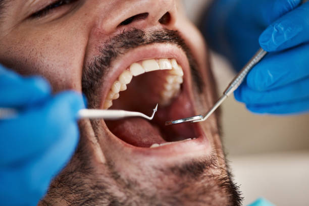 Best Emergency Dental Care for Broken or Chipped Teeth in Poquonock Bridge, CT